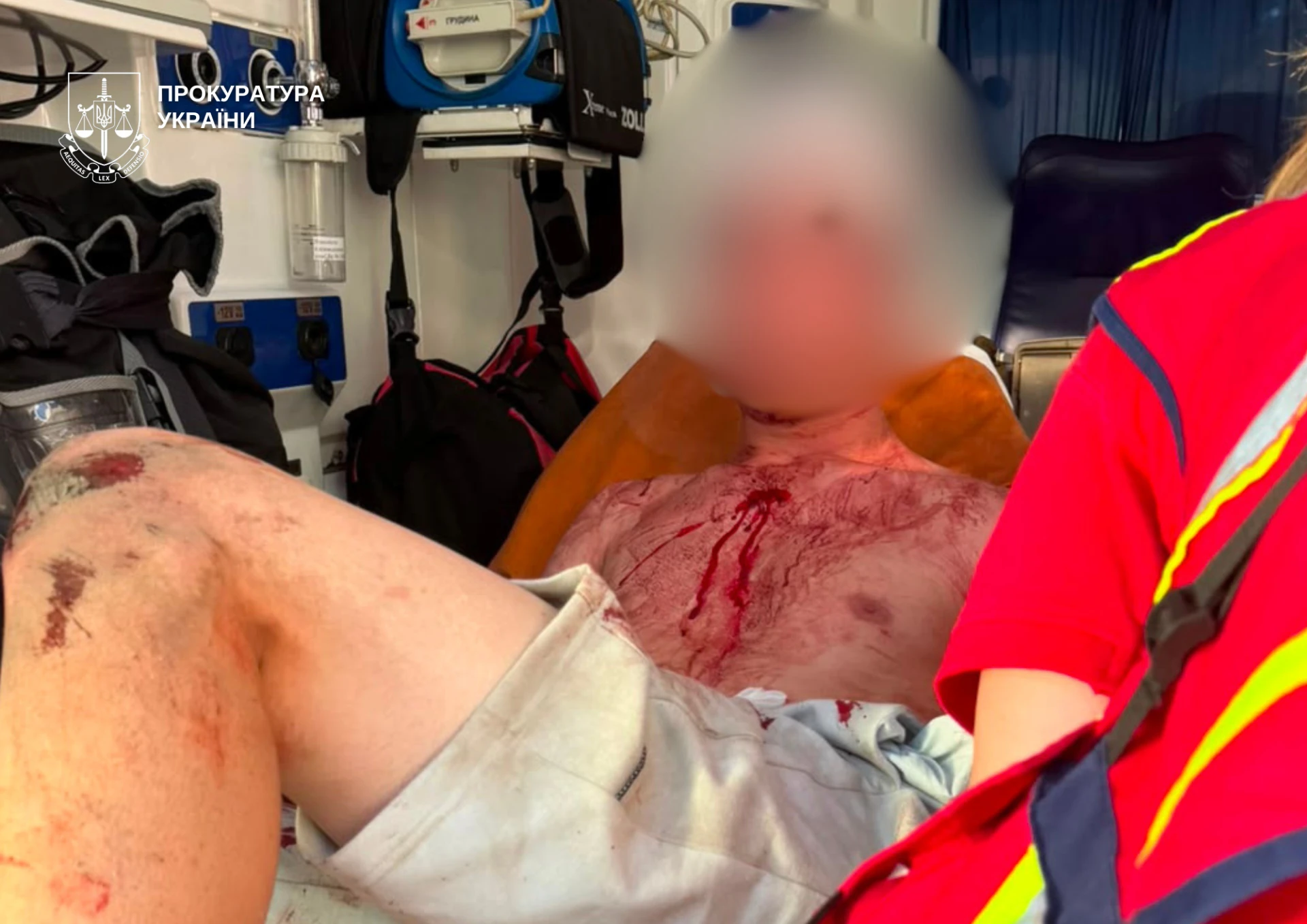 Судове засідання щодо арешту 19-річного підозрюваного у нападі з ножем